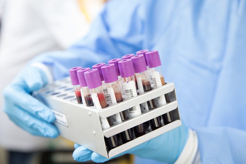 Artiva shutting down cell therapy, cuts 94% of staff after two trial deaths