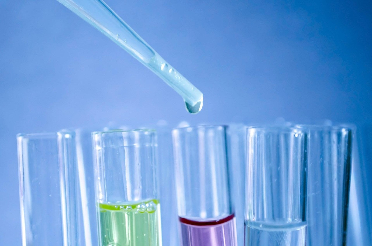Representative image: chemistry lab glassware
