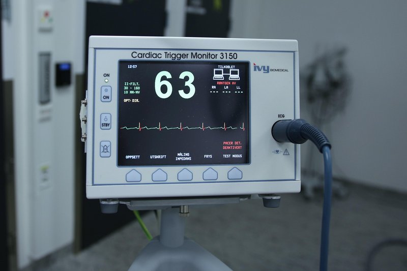 Representative image: ecg heart monitor