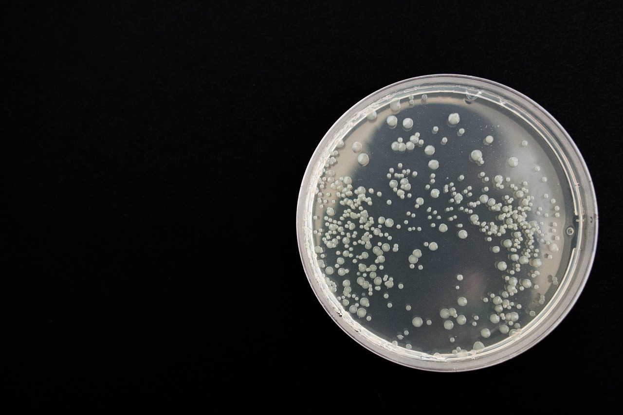 Representative image: laboratory petri dish bacteria