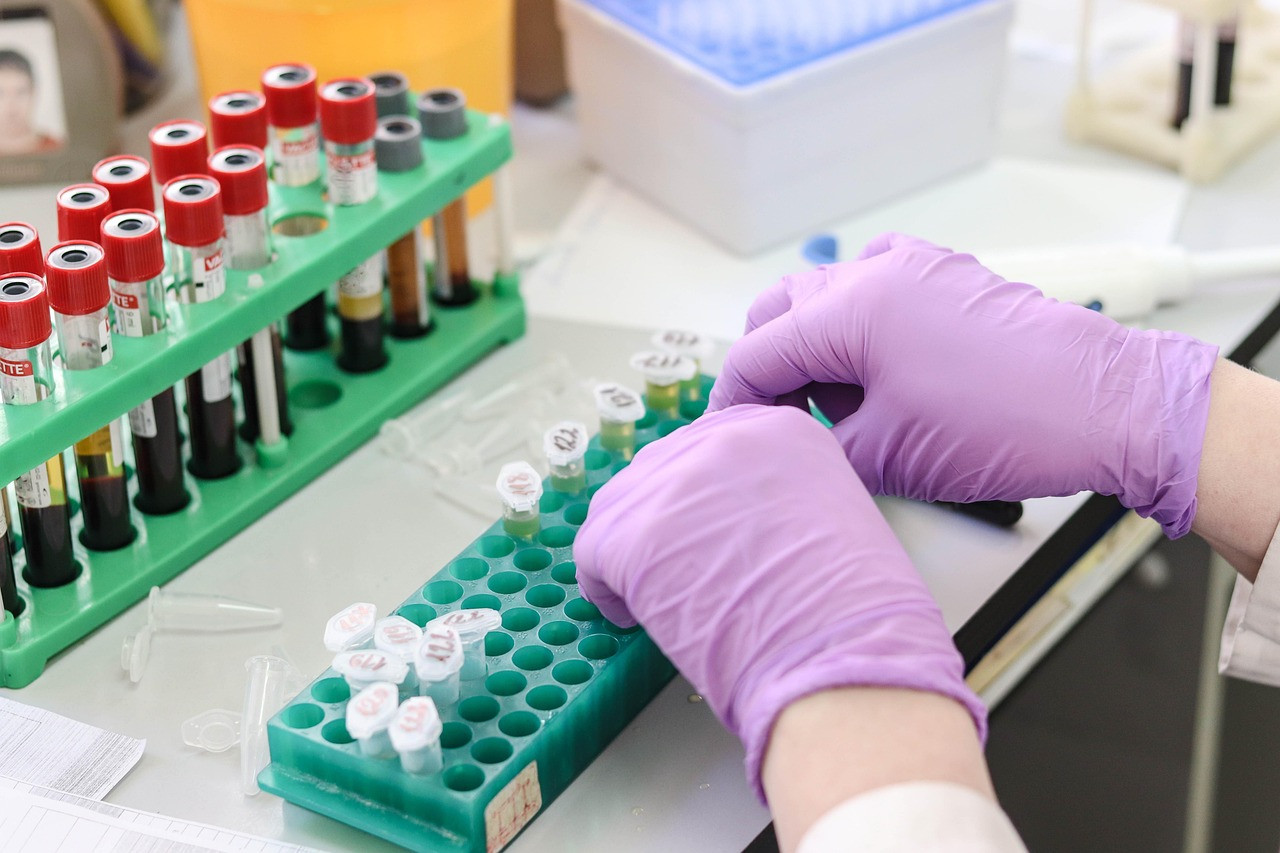 Representative image: laboratory scientist test tubes