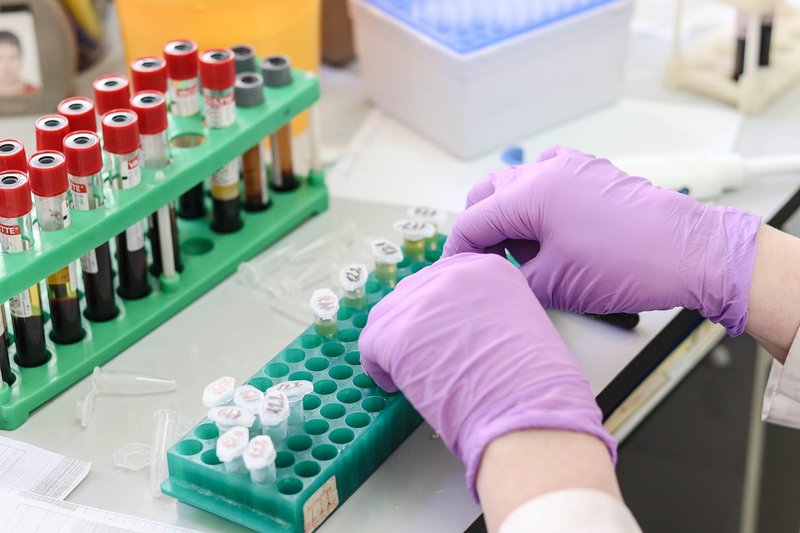 Representative image: laboratory scientist test tubes