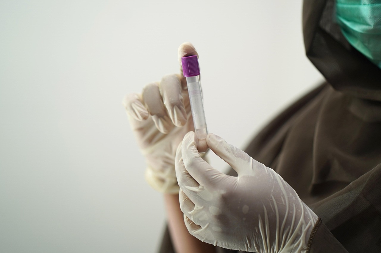 Representative image: laboratory test tubes