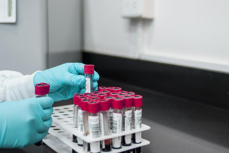 Russia denies second plague case as WHO says Siberian lab worker's death unexplained