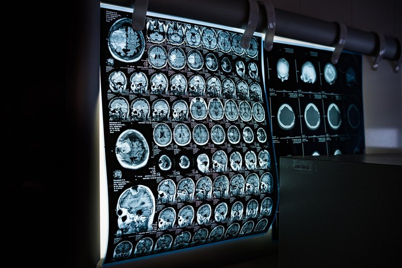 Sabi raises $50 million seed, led by Khosla, for brain-to-AI interface in a cap